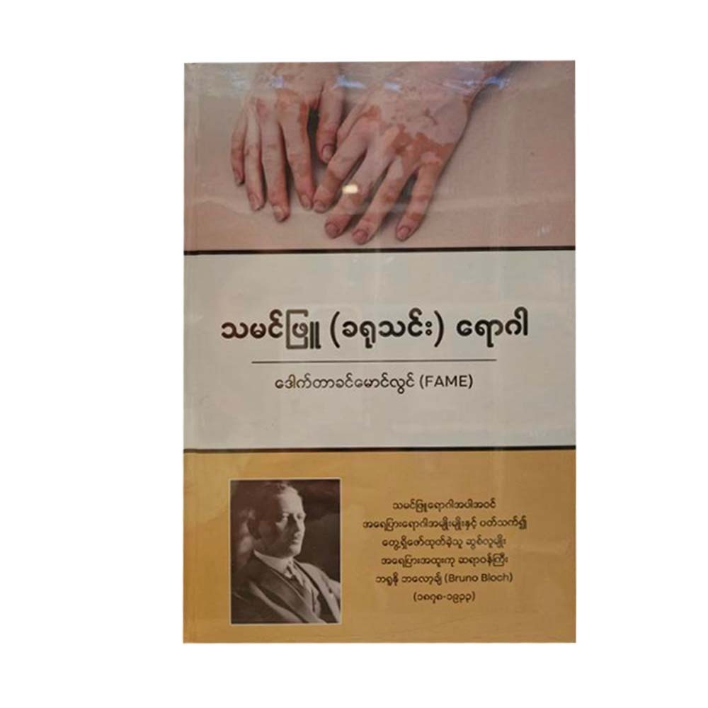 သမင်ဖြူ (ခရုသင်း) ရောဂါ(Vitiligo)-ဒေါက်တာခင်မောင်လွင်