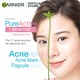 Garnier Pure Active Anti-Acne Cleansing Gel 100ML