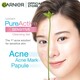 Garnier Pure Active Sensitive Anti-Acne Facial Cleansing Gel 100ML